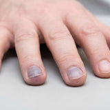 Blue Nail Beds (Cyanosis): Identifying Nail Discoloration and When to Get Help - Funeral.com, Inc.